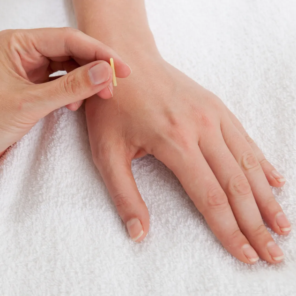 O que é Agulhamento Distal