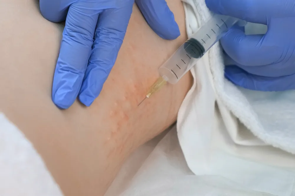 Ozonioterapia Medicinal - Benefícios, Indicações e Efeitos Colaterais