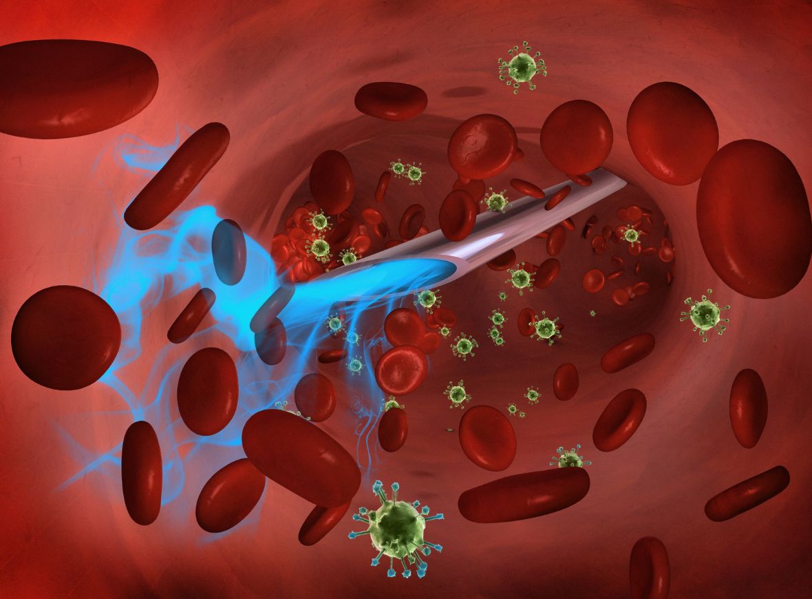 Auto-Hemoterapia com Ozônio é uma prática que envolve a retirada de sangue do próprio paciente e sua reintrodução por via intramuscular, estimulando o sistema imunológico e promovendo a desintoxicação do organismo.