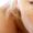 Melasma - Os benefícios de se tratar com a ozonioterapia