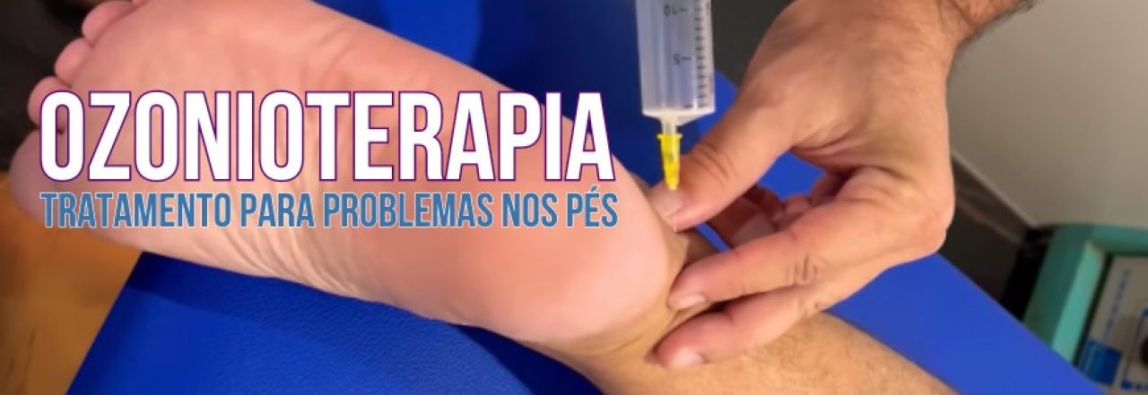 Ozonioterapia: Tratamento para problemas nos pés