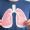 A ozonioterapia representa uma ferramenta terapêutica complementar extremamente promissora no manejo das doenças respiratórias.