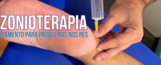 Ozonioterapia: Tratamento para problemas nos pés